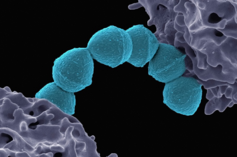 Streptococcus
